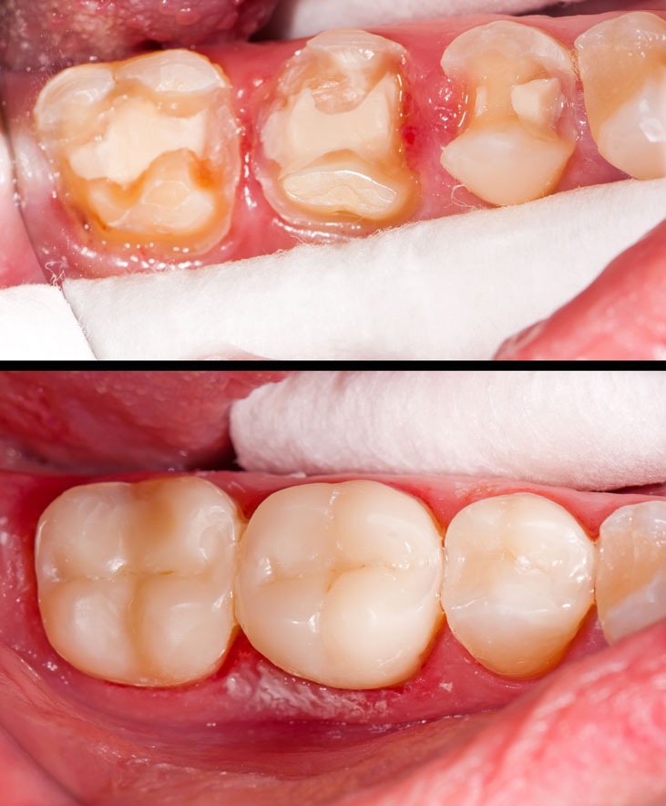 Poa Odontologia Est Tica Dental Aruj Dr Almir Feitosa