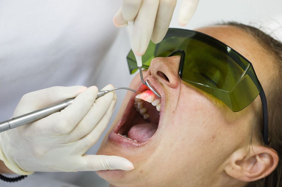 Tratamento de Gengiva na Poa Odontologia