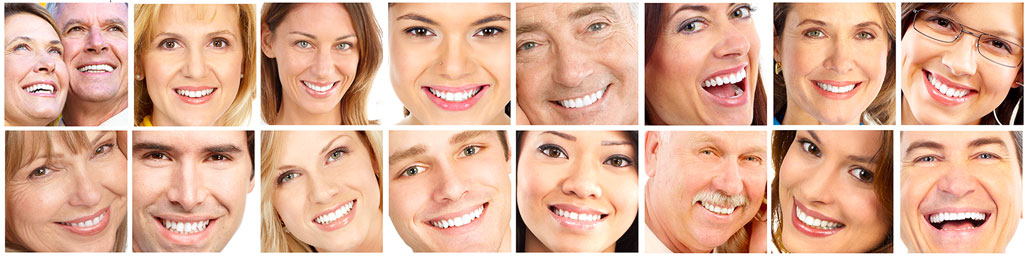 Estetica dental, clareamento dental e trocas fe restauracao