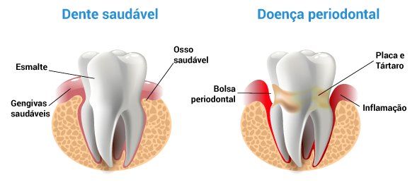 tratamentos de problemas na gengiva poa odontologia